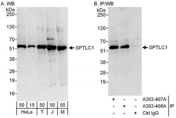 Anti-SPTLC1