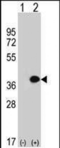 Anti-MLF1, CT (MLF1, Myeloid leukemia factor 1, Myelodysplasia-myeloid leukemia factor 1) (Azide fre