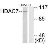 Anti-HDAC7