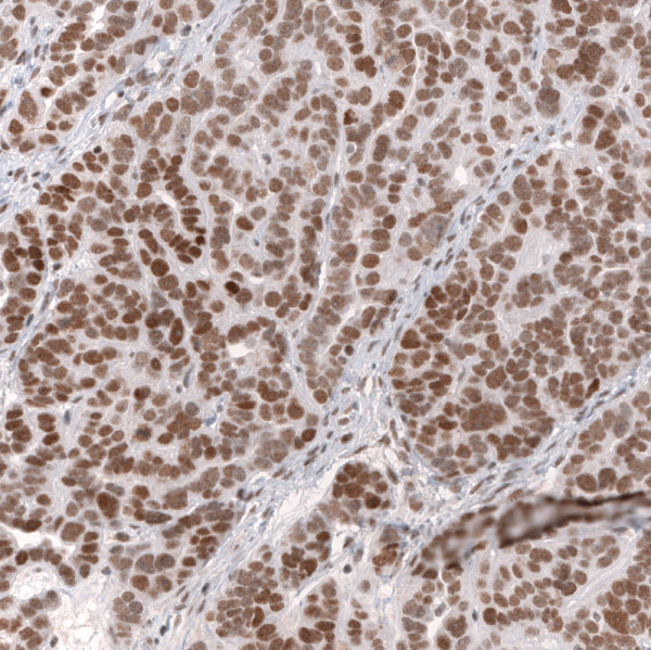 Anti-SMARCB1, clone CL13973