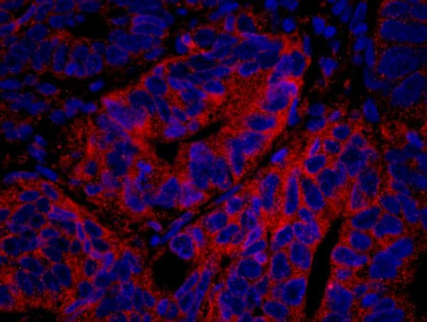 Anti-PTPN12 IHC Antibody, affinity purifie (IHC)