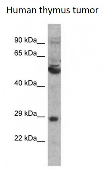 Anti-SLC13A5