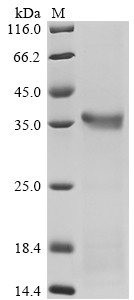 Mannan-binding protein (Mbl2), mouse, recombinant