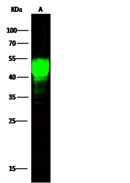 Anti-ASGPR1 Monoclonal Recombinant Antibody