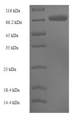 Sulfite oxidase, mitochondrial (SUOX), human, recombinant