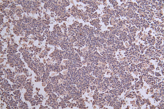 Anti-THEMIS Recombinant Monoclonal, clone 7G7