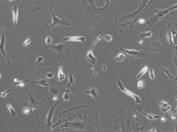 HBL-52 Cells