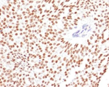 Anti-FOXA1 / HNF3A, clone FHBA1-1