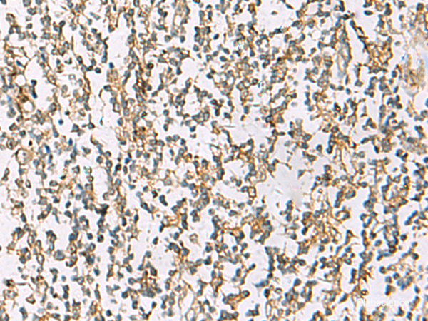Anti-ZPBP2