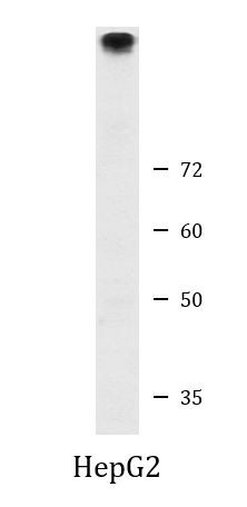 Anti-TRPM3