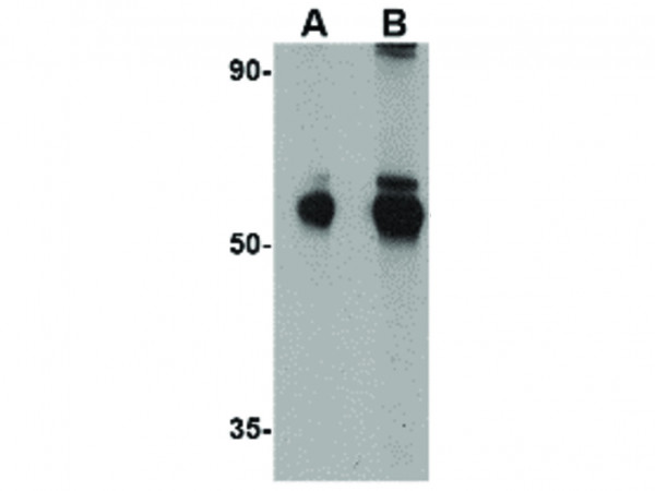 Anti-Aldh5A1