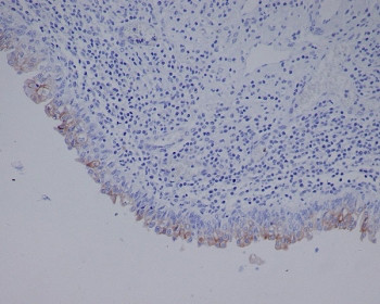 Anti-Uroplakin 3a / UPK3A, clone AFEH-21