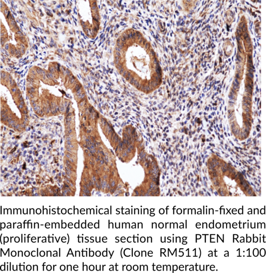 Anti-PTEN Rabbit (Clone RM511)