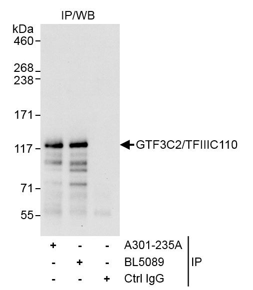 Anti-GTF3C2/TFIIIC110