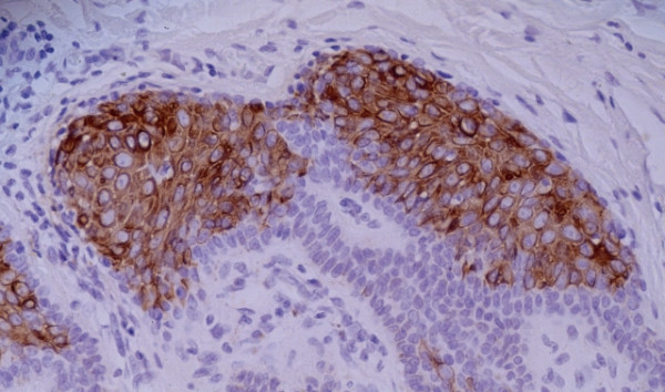 Anti-Cytokeratin 10, clone VIK-10