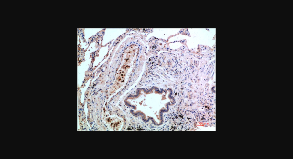 Anti-P38 (1G1), monoclonal