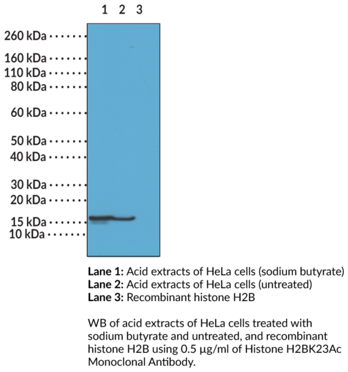 Anti-Histone H2BK23Ac Monoclonal Antibody (Clone RM260)