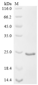 Vesicular glutamate transporter 2 (Slc17a6), partial, rat, recombinant