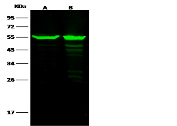 Anti-ALDH7A1 Monoclonal Recombinant Antibody