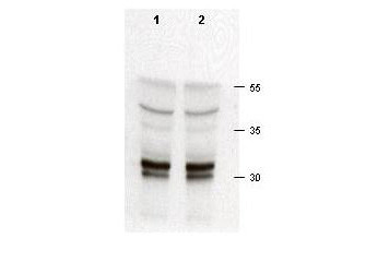 Anti-cdk2 (Cyclin-dependent Kinase 2)