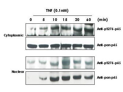 Anti-phospho-NFkappaB p65 (Ser529) (NFkB, Nuclear Factor kappa B)