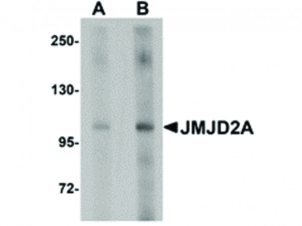 Anti-JMJD2A