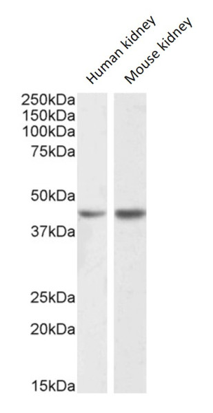 Anti-NPHS2 / Podocin
