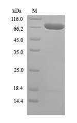 AT-rich interactive domain-containing protein 5A (Arid5a), mouse, recombinant