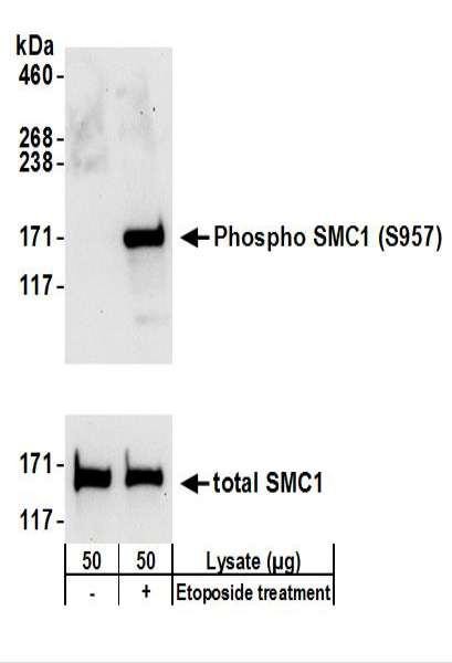 Anti-phospho-SMC1 (Ser957)