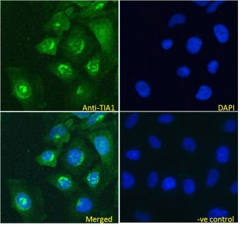 Anti-TIA1 / T-Cell Intracellular Antigen-1