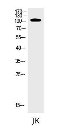 Anti-phospho-EphA7 (Tyr791)