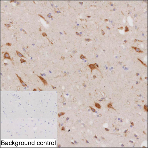 Anti-SPARCL1