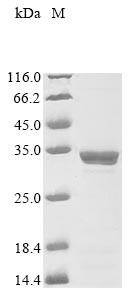 Matrix protein (M), human metapneumovirus, recombinant