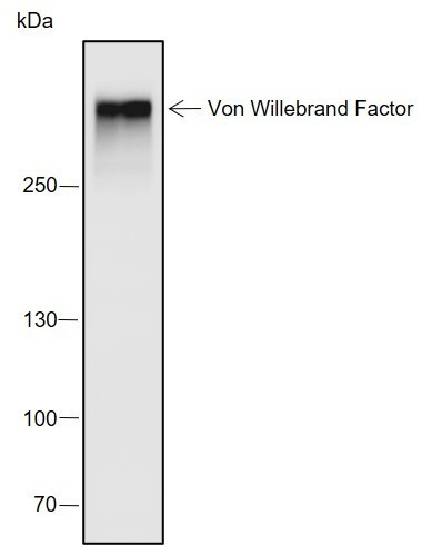 Anti-Recombinant Von Willebrand Factor, clone A683