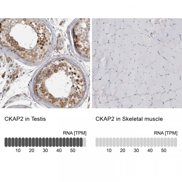 Anti-CKAP2