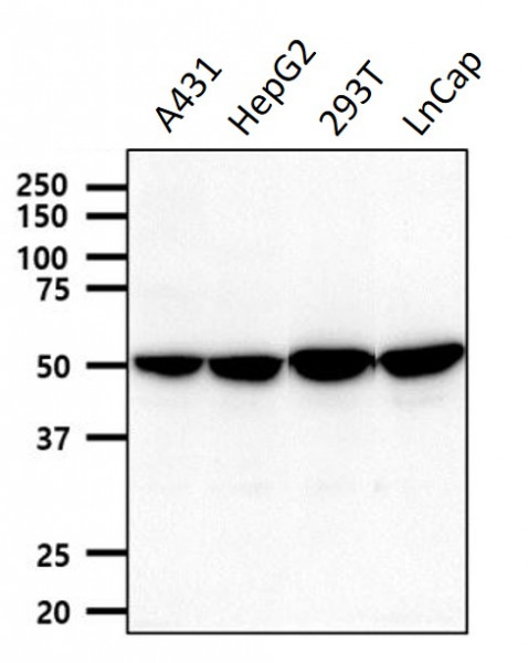 Anti-Pyruvate dehydrogenase / PDHX, clone 1E11
