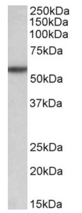 Anti-TGF beta Receptor I