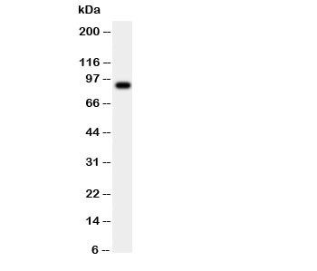 Anti-CSF3R / Colony Stimulating Factor 3 Receptor