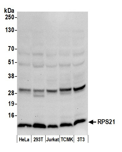 Anti-RPS21/Ribosomal Protein S21