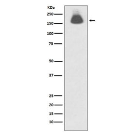 Anti-phospho-EGF Receptor / EGFR (Ser695), clone GCC-5