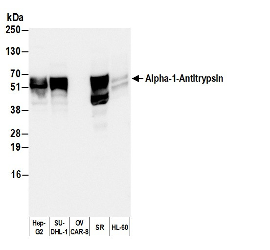 Anti-Human Alpha-1-Antitrypsin, Biotin conjugated