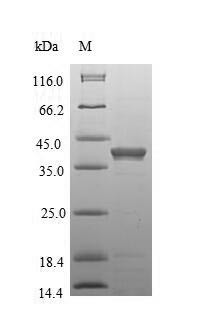 Anthrax toxin receptor 1 (Antxr1), partial, mouse, recombinant