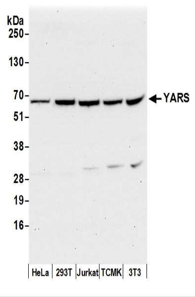 Anti-YARS/Tyrosyl-tRNA Synthetase/TYRRS