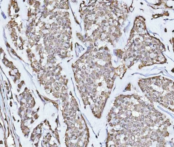 Anti-PPM1G / PP2C gamma