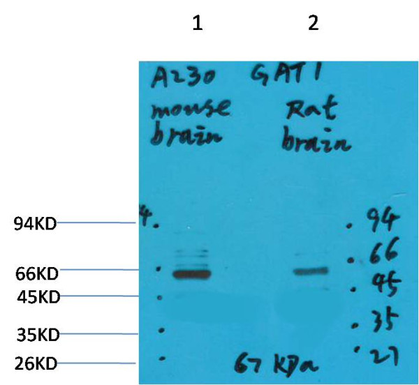 Anti-GABA Transporter 1