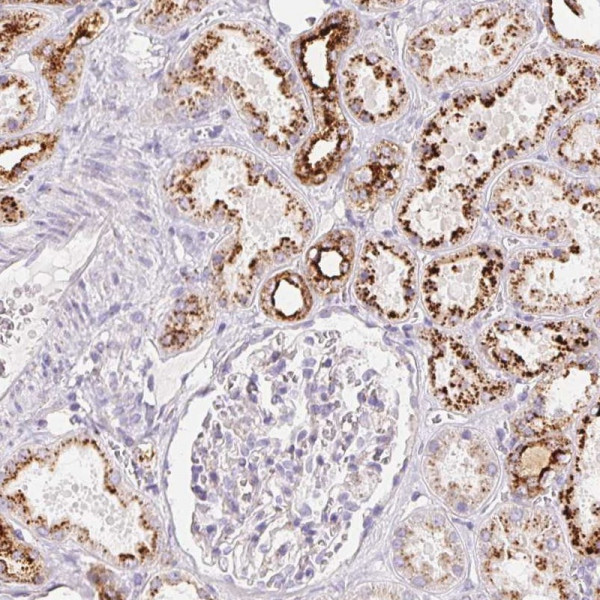 Anti-SCPEP1