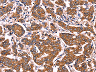 Anti-COL20A1