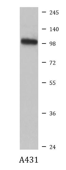 Anti-alpha Actinin 4