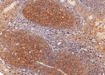 Anti-CD82/KAI-1 Monoclonal Antibody