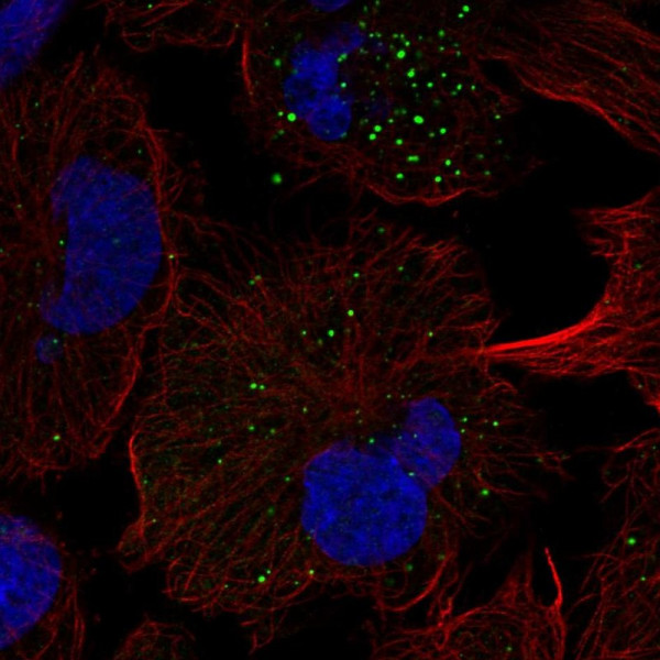 Anti-FGFRL1